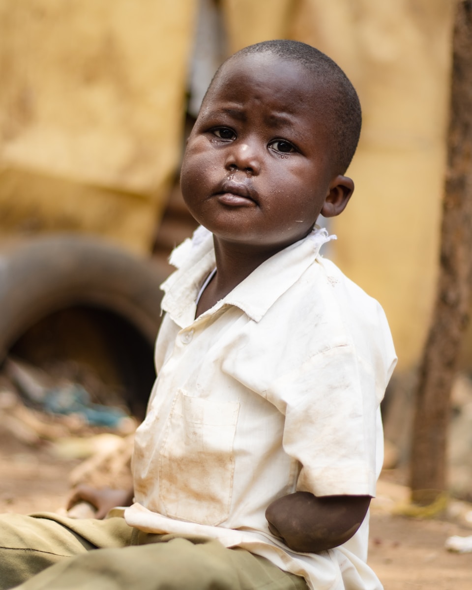 Child malnutrition Nigeria