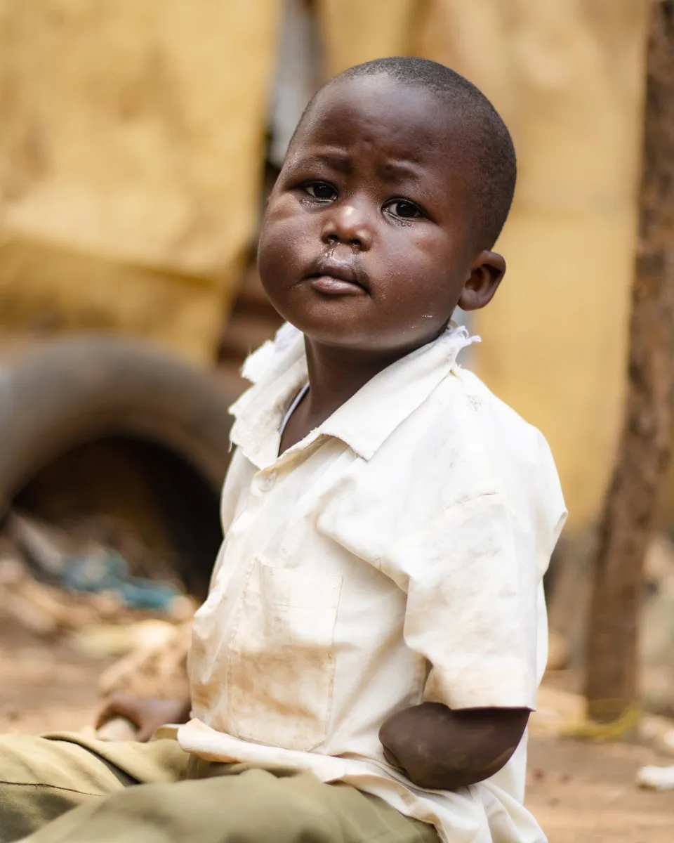 Child malnutrition Nigeria